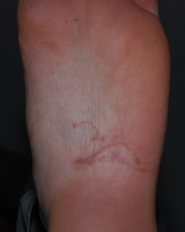 Blickdiagnose-Quiz Fall 30: klinisches Bild – welche Diagnose?