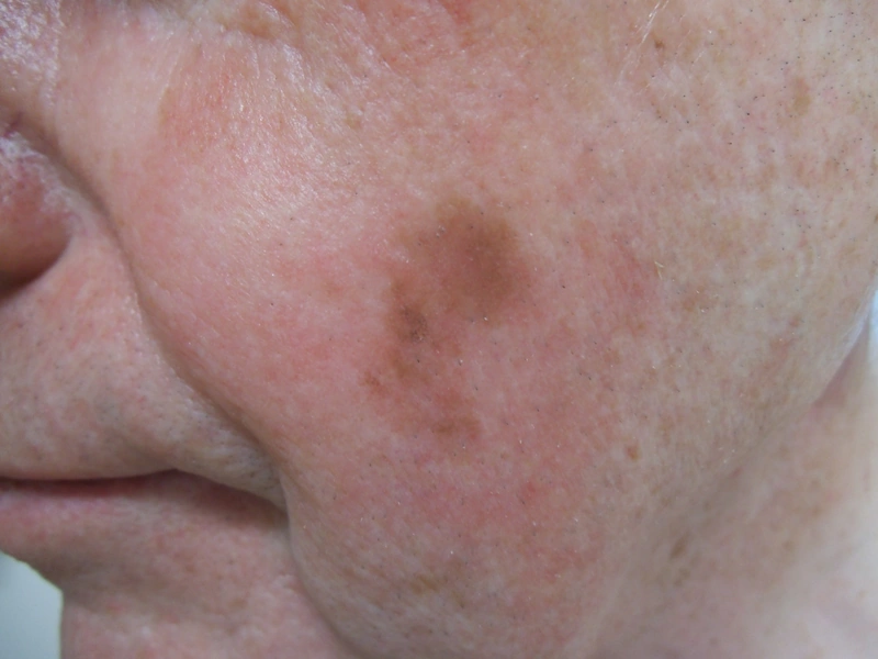 Spot-diagnosis quiz case 8: clinical image – which diagnosis?