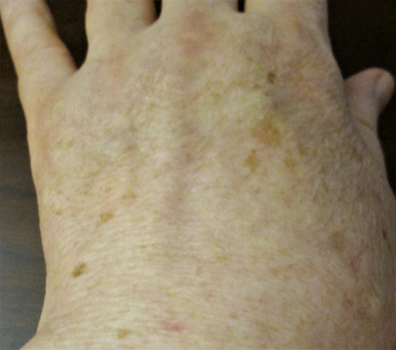 Spot-diagnosis quiz case 9: clinical image – which diagnosis?