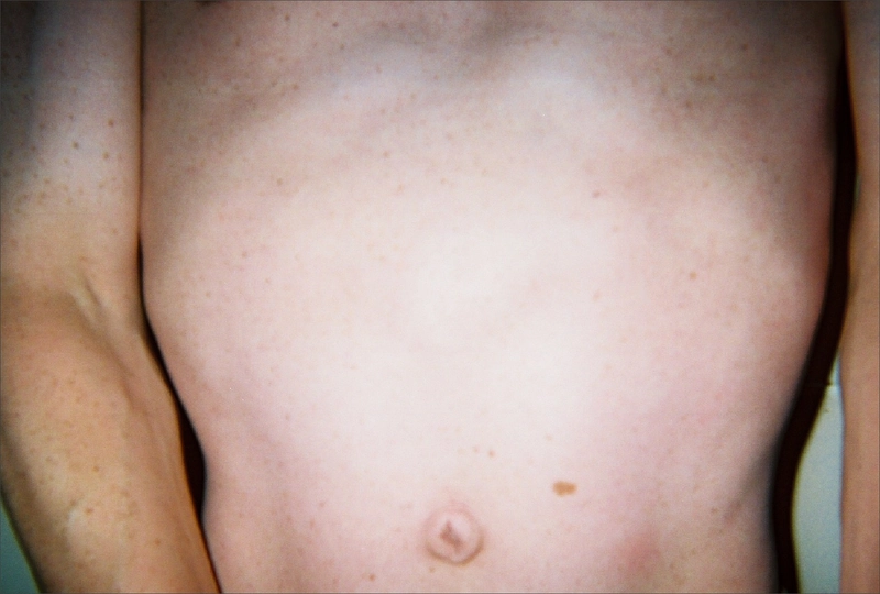Blickdiagnose-Quiz Fall 5: klinisches Bild – welche Diagnose?