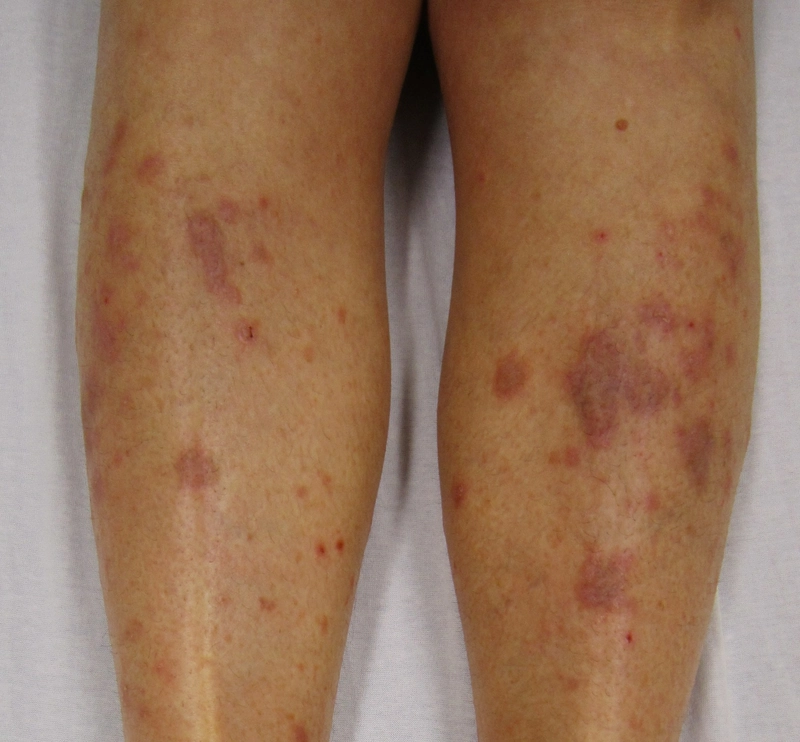 Blickdiagnose-Quiz Fall 34: klinisches Bild – welche Diagnose?
