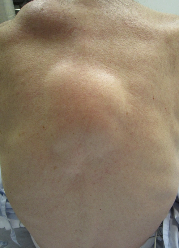 Spot-diagnosis quiz case 10: clinical image – which diagnosis?