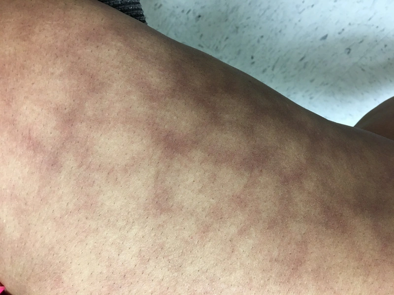 Blickdiagnose-Quiz Fall 2: klinisches Bild – welche Diagnose?