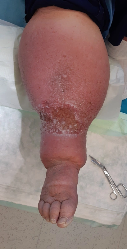 Blickdiagnose-Quiz Fall 32: klinisches Bild – welche Diagnose?