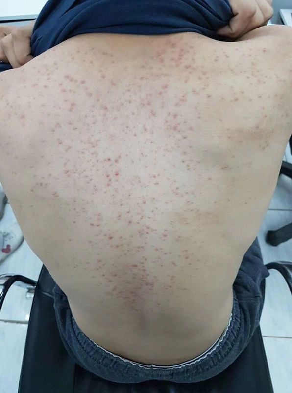 Blickdiagnose-Quiz Fall 33: klinisches Bild – welche Diagnose?