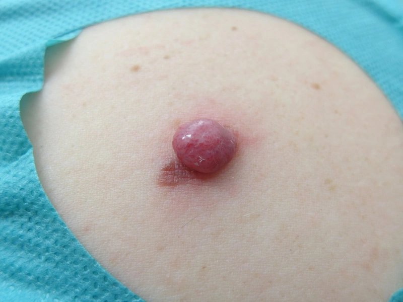 Spot-diagnosis quiz case 29: clinical image – which diagnosis?