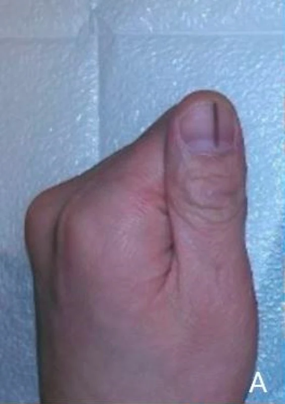 Blickdiagnose-Quiz Fall 10: klinisches Bild – welche Diagnose?