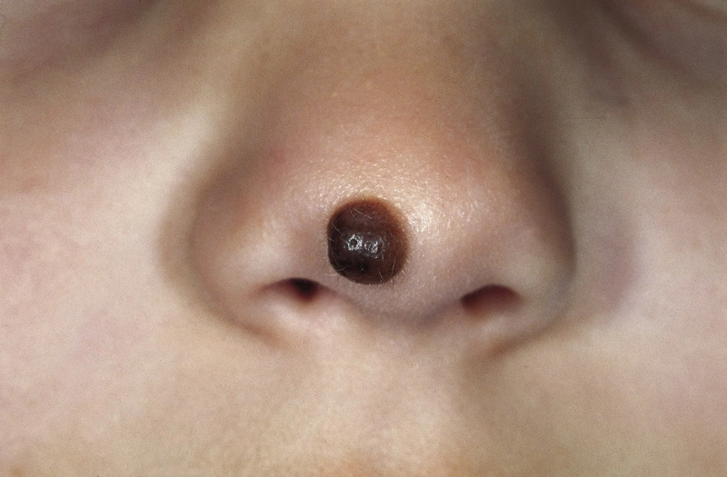 Spot-diagnosis quiz case 12: clinical image – which diagnosis?