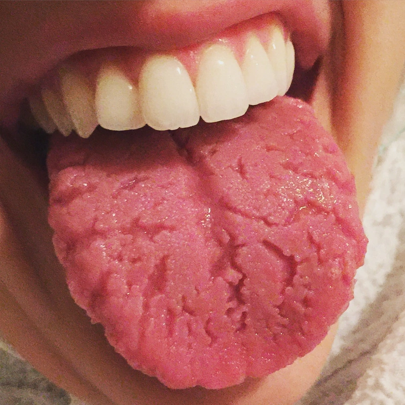 Blickdiagnose-Quiz Fall 11: klinisches Bild – welche Diagnose?