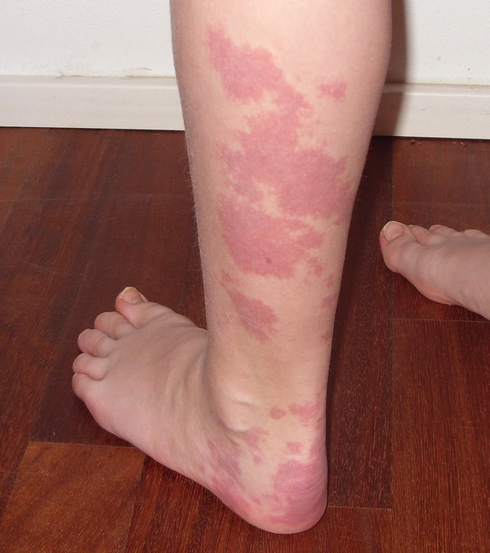 Spot-diagnosis quiz case 14: clinical image – which diagnosis?