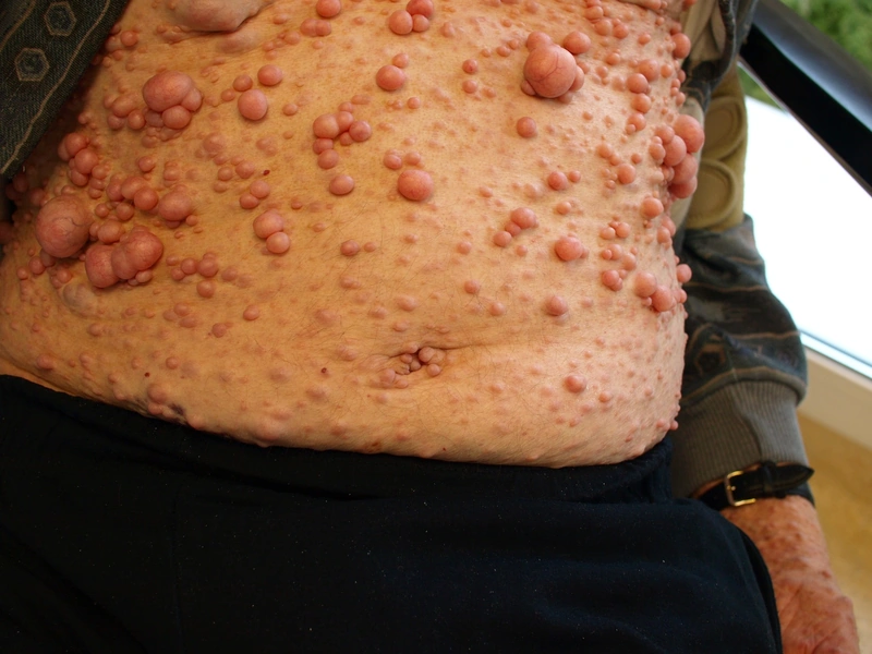 Spot-diagnosis quiz case 31: clinical image – which diagnosis?