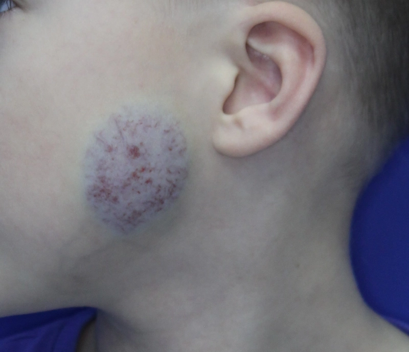 Spot-diagnosis quiz case 39: clinical image – which diagnosis?