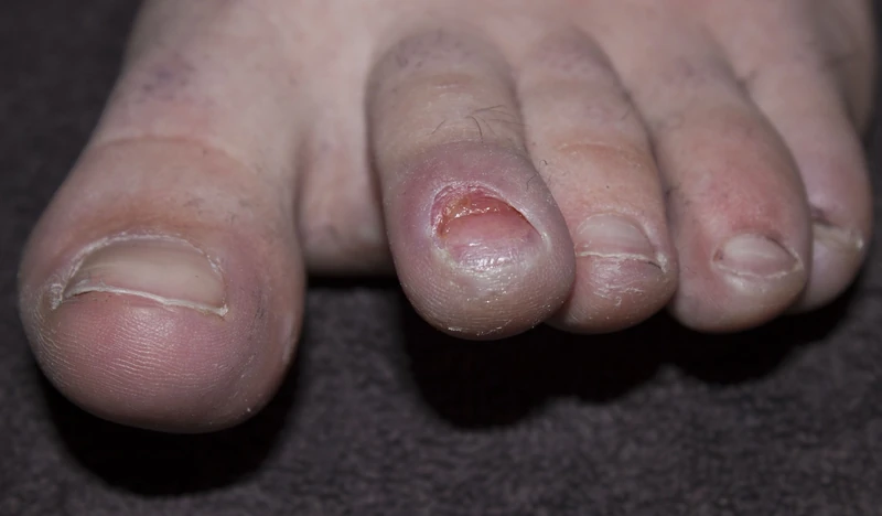 Blickdiagnose-Quiz Fall 12: klinisches Bild – welche Diagnose?