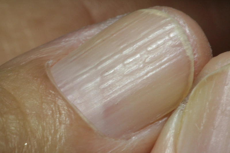 Blickdiagnose-Quiz Fall 13: klinisches Bild – welche Diagnose?
