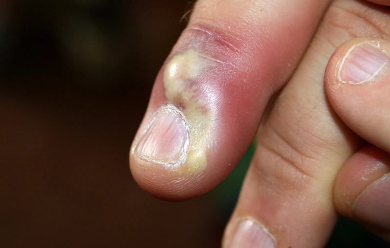 Blickdiagnose-Quiz Fall 2: klinisches Bild – welche Diagnose?