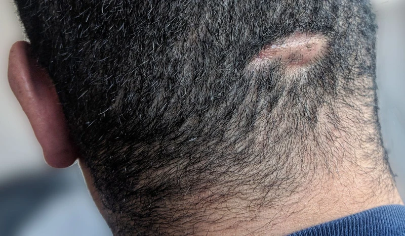 Blickdiagnose-Quiz Fall 39: klinisches Bild – welche Diagnose?