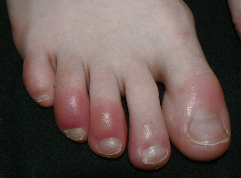 Blickdiagnose-Quiz Fall 14: klinisches Bild – welche Diagnose?
