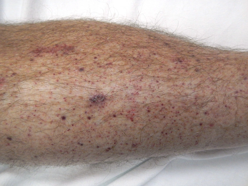 Blickdiagnose-Quiz Fall 15: klinisches Bild – welche Diagnose?