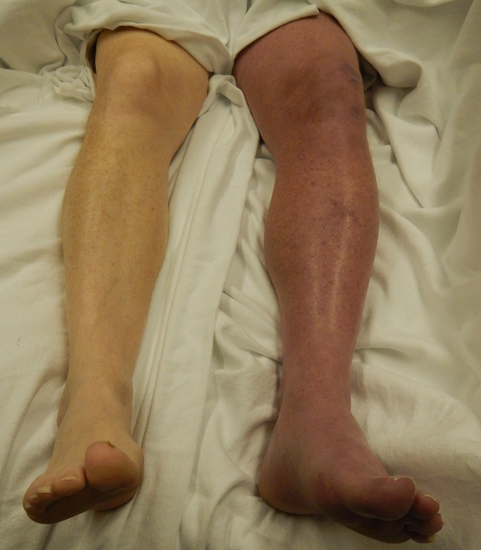 Blickdiagnose-Quiz Fall 16: klinisches Bild – welche Diagnose?