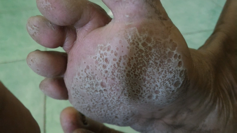 Spot-diagnosis quiz case 15: clinical image – which diagnosis?