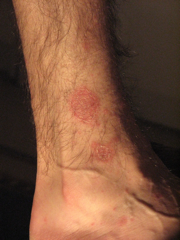 Blickdiagnose-Quiz Fall 7: klinisches Bild – welche Diagnose?