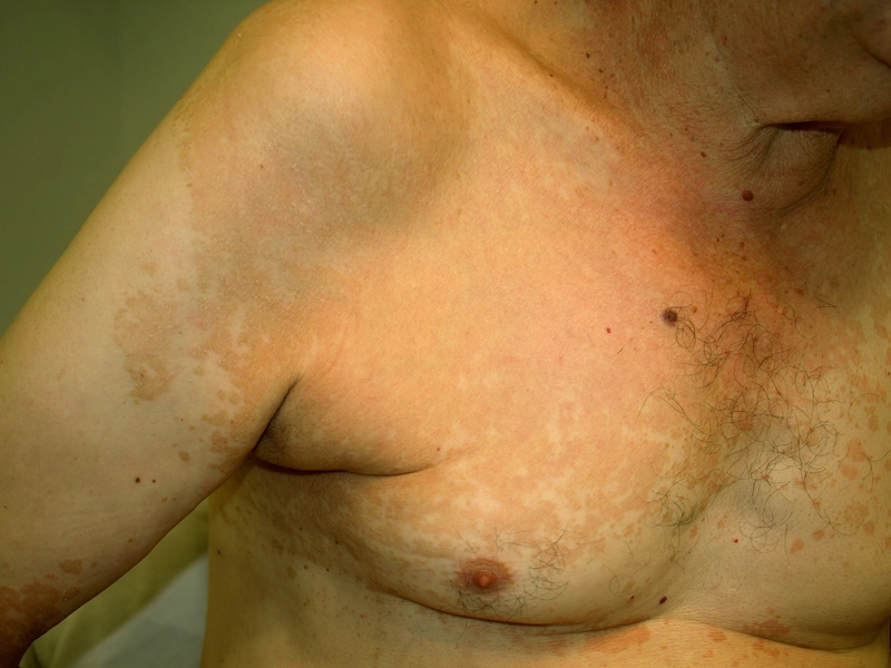Blickdiagnose-Quiz Fall 8: klinisches Bild – welche Diagnose?