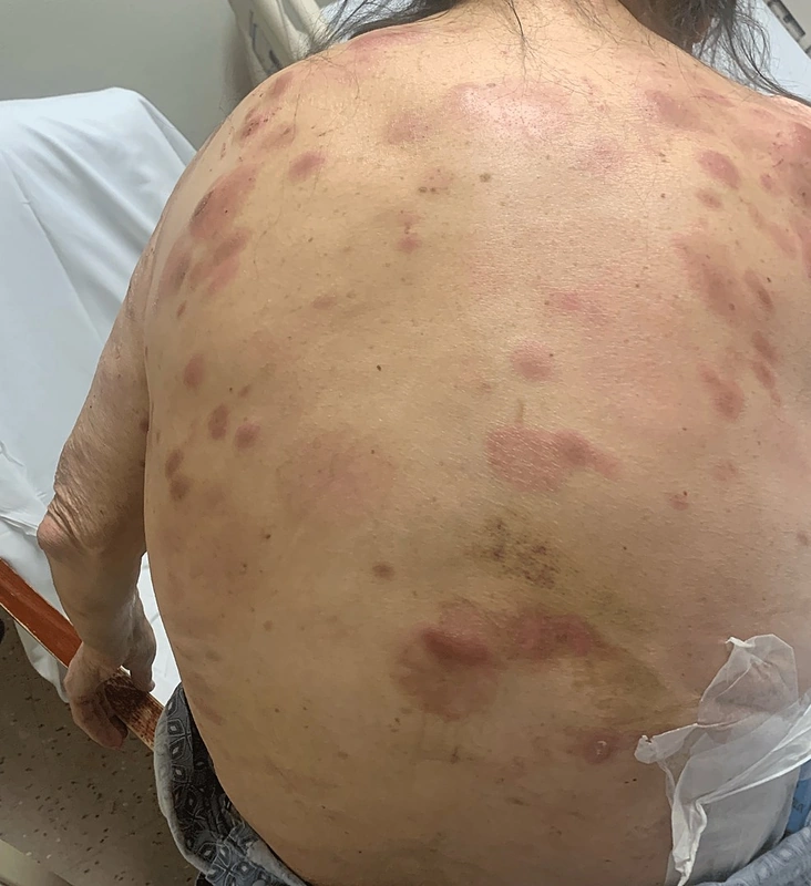 Spot-diagnosis quiz case 33: clinical image – which diagnosis?