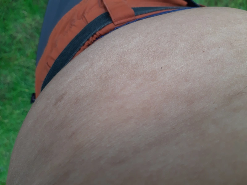 Blickdiagnose-Quiz Fall 7: klinisches Bild – welche Diagnose?