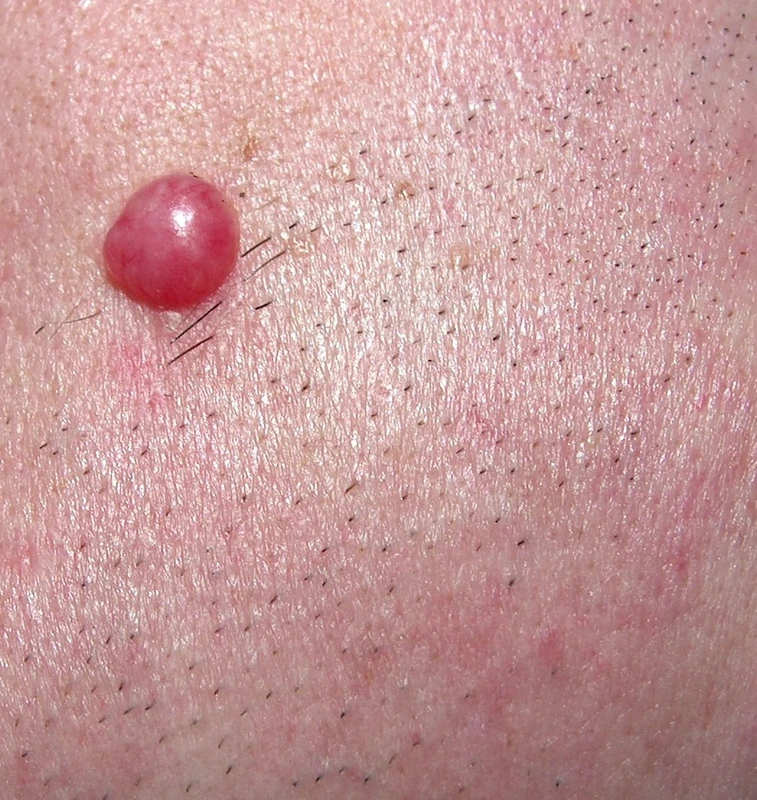 Spot-diagnosis quiz case 40: clinical image – which diagnosis?