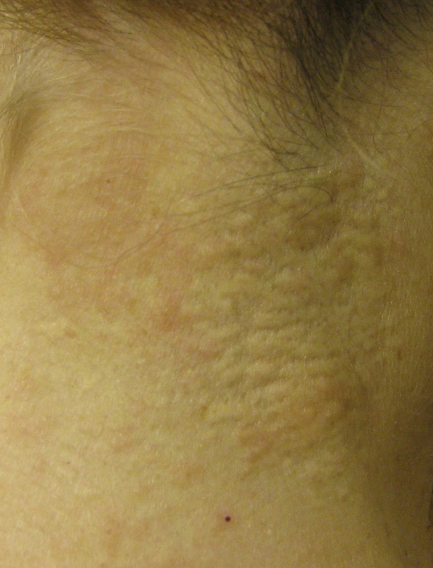 Spot-diagnosis quiz case 41: clinical image – which diagnosis?