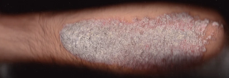 Blickdiagnose-Quiz Fall 10: klinisches Bild – welche Diagnose?