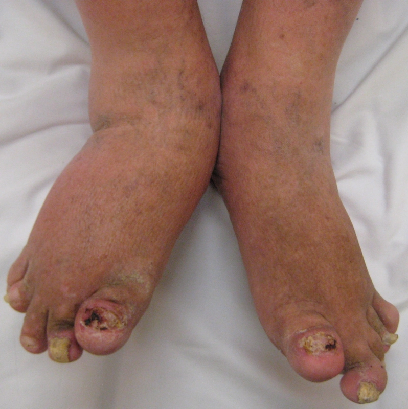Blickdiagnose-Quiz Fall 57: klinisches Bild – welche Diagnose?