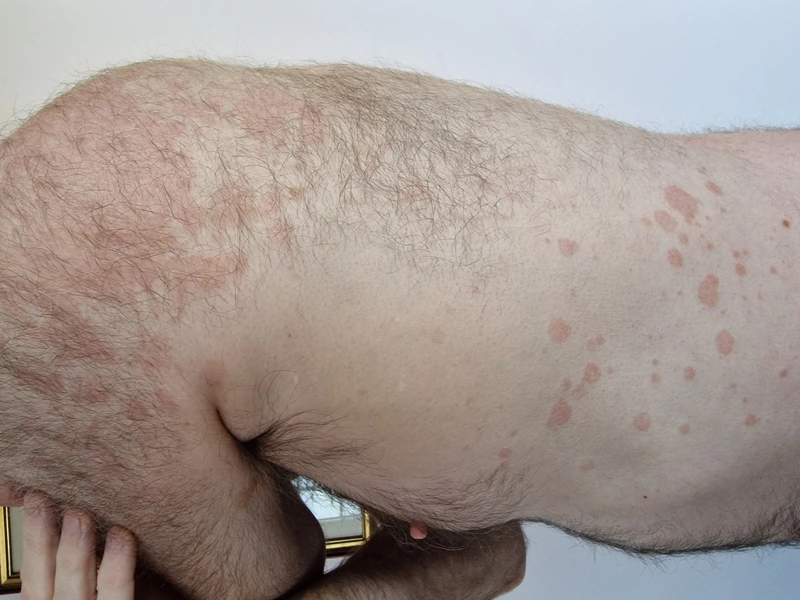 Blickdiagnose-Quiz Fall 11: klinisches Bild – welche Diagnose?