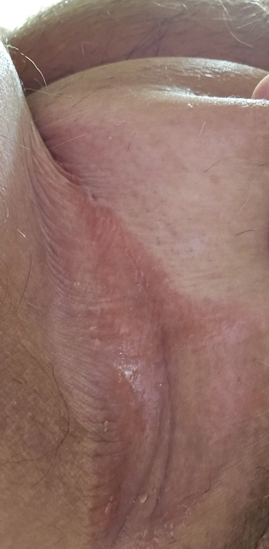 Blickdiagnose-Quiz Fall 43: klinisches Bild – welche Diagnose?