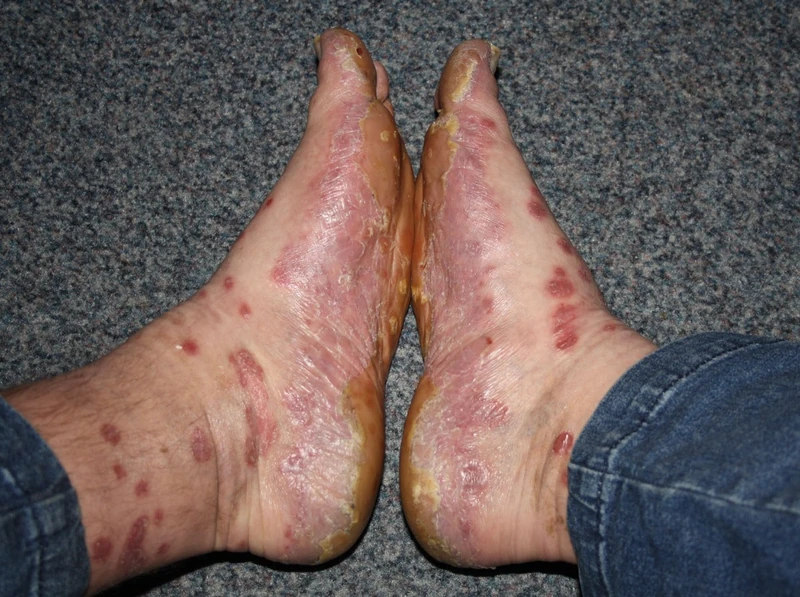 Blickdiagnose-Quiz Fall 12: klinisches Bild – welche Diagnose?