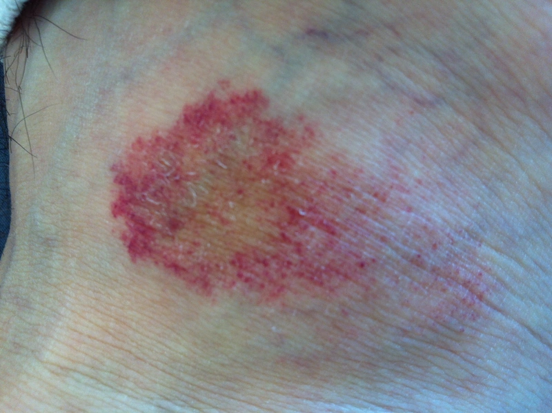 Blickdiagnose-Quiz Fall 23: klinisches Bild – welche Diagnose?