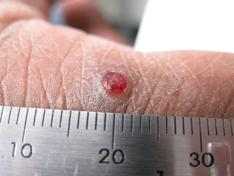 Spot-diagnosis quiz case 34: clinical image – which diagnosis?