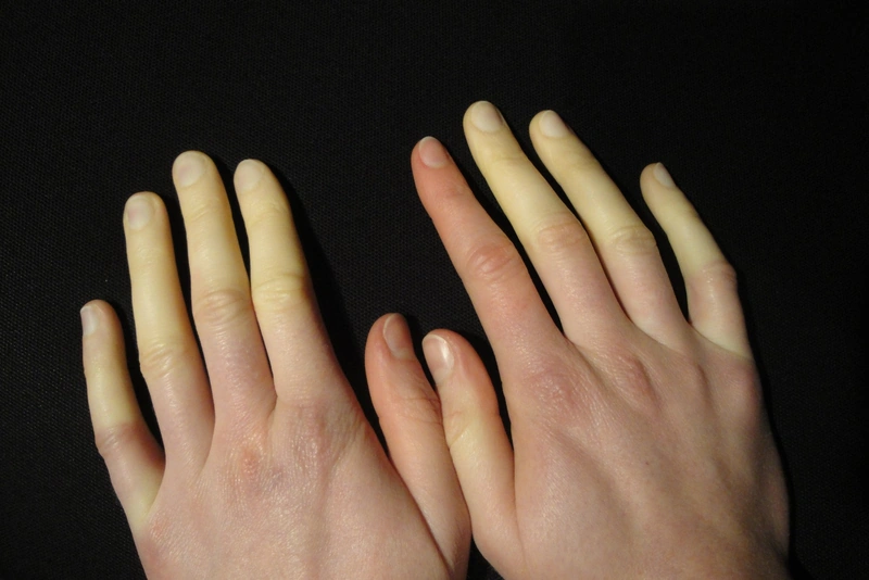 Blickdiagnose-Quiz Fall 3: klinisches Bild – welche Diagnose?