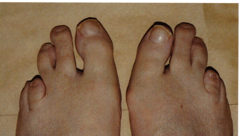 Blickdiagnose-Quiz Fall 12: klinisches Bild – welche Diagnose?
