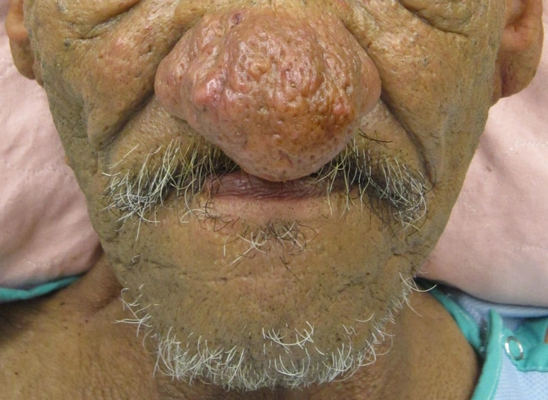 Blickdiagnose-Quiz Fall 13: klinisches Bild – welche Diagnose?