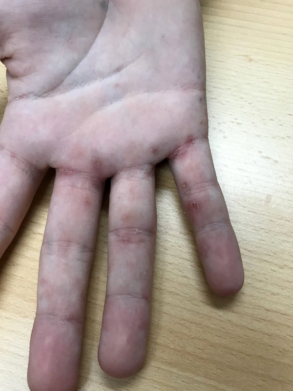Blickdiagnose-Quiz Fall 37: klinisches Bild – welche Diagnose?