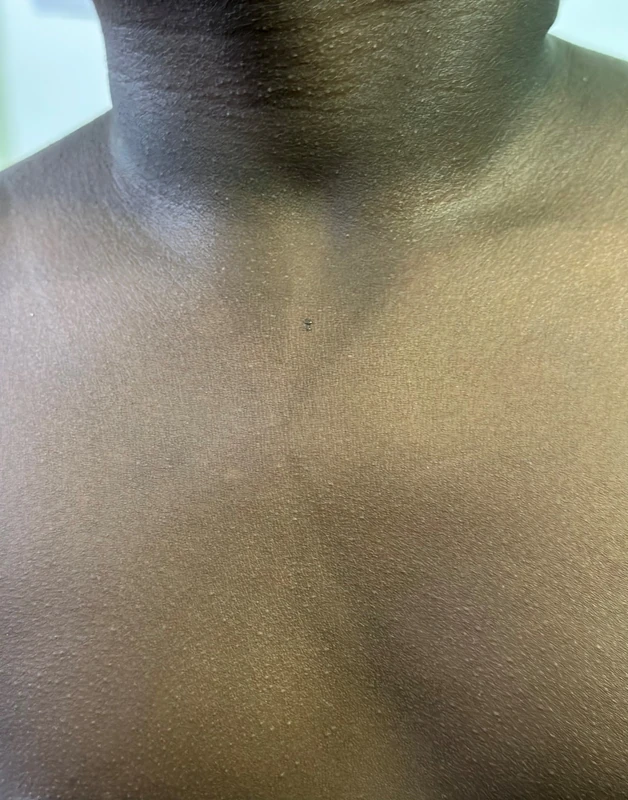 Blickdiagnose-Quiz Fall 9: klinisches Bild – welche Diagnose?