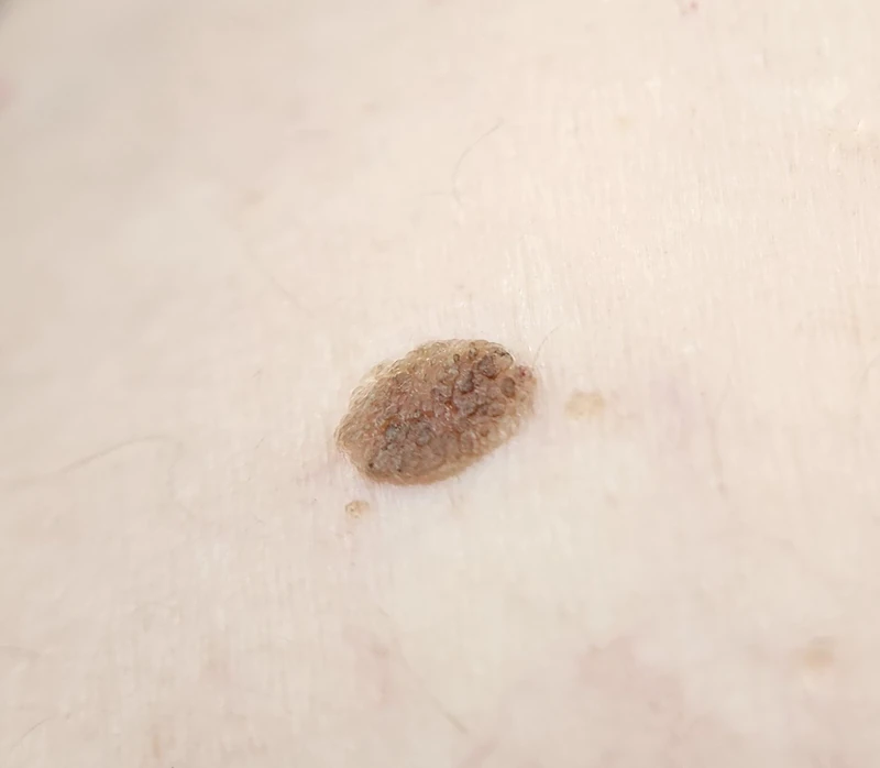 Spot-diagnosis quiz case 16: clinical image – which diagnosis?