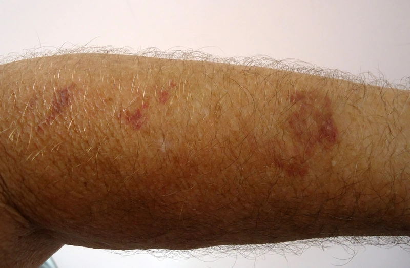 Blickdiagnose-Quiz Fall 4: klinisches Bild – welche Diagnose?