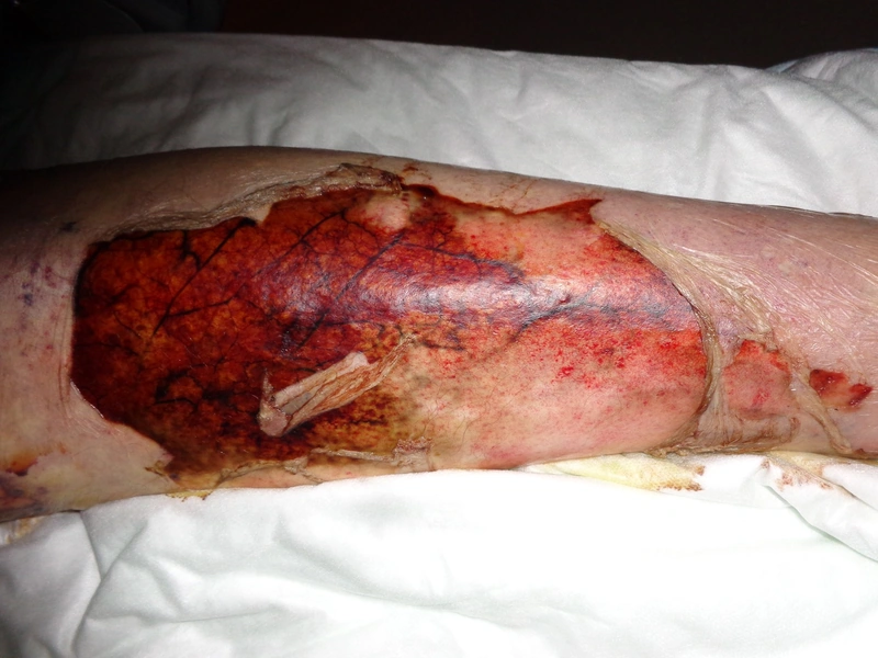 Blickdiagnose-Quiz Fall 46: klinisches Bild – welche Diagnose?