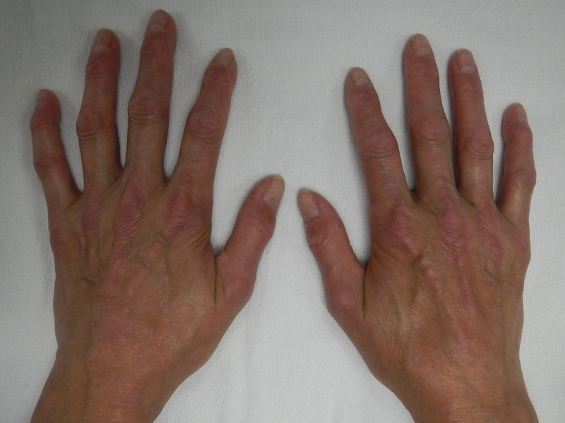 Blickdiagnose-Quiz Fall 47: klinisches Bild – welche Diagnose?