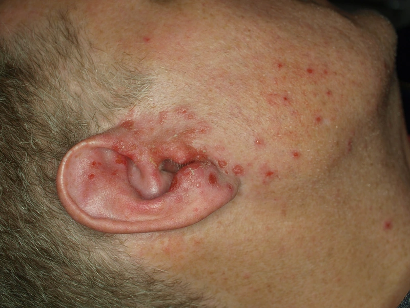 Blickdiagnose-Quiz Fall 39: klinisches Bild – welche Diagnose?