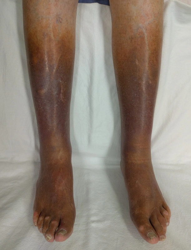 Blickdiagnose-Quiz Fall 17: klinisches Bild – welche Diagnose?