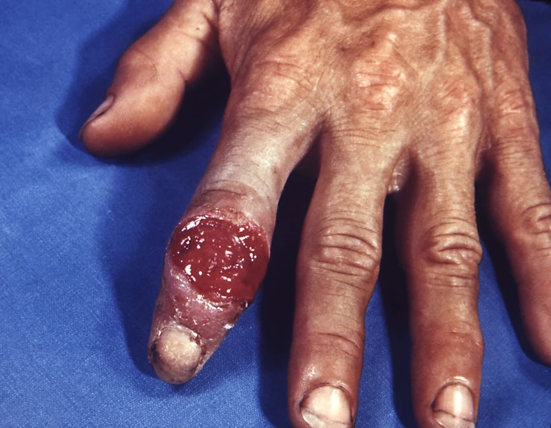 Blickdiagnose-Quiz Fall 40: klinisches Bild – welche Diagnose?