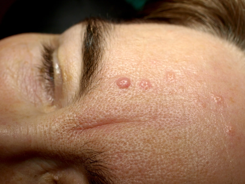 Spot-diagnosis quiz case 17: clinical image – which diagnosis?